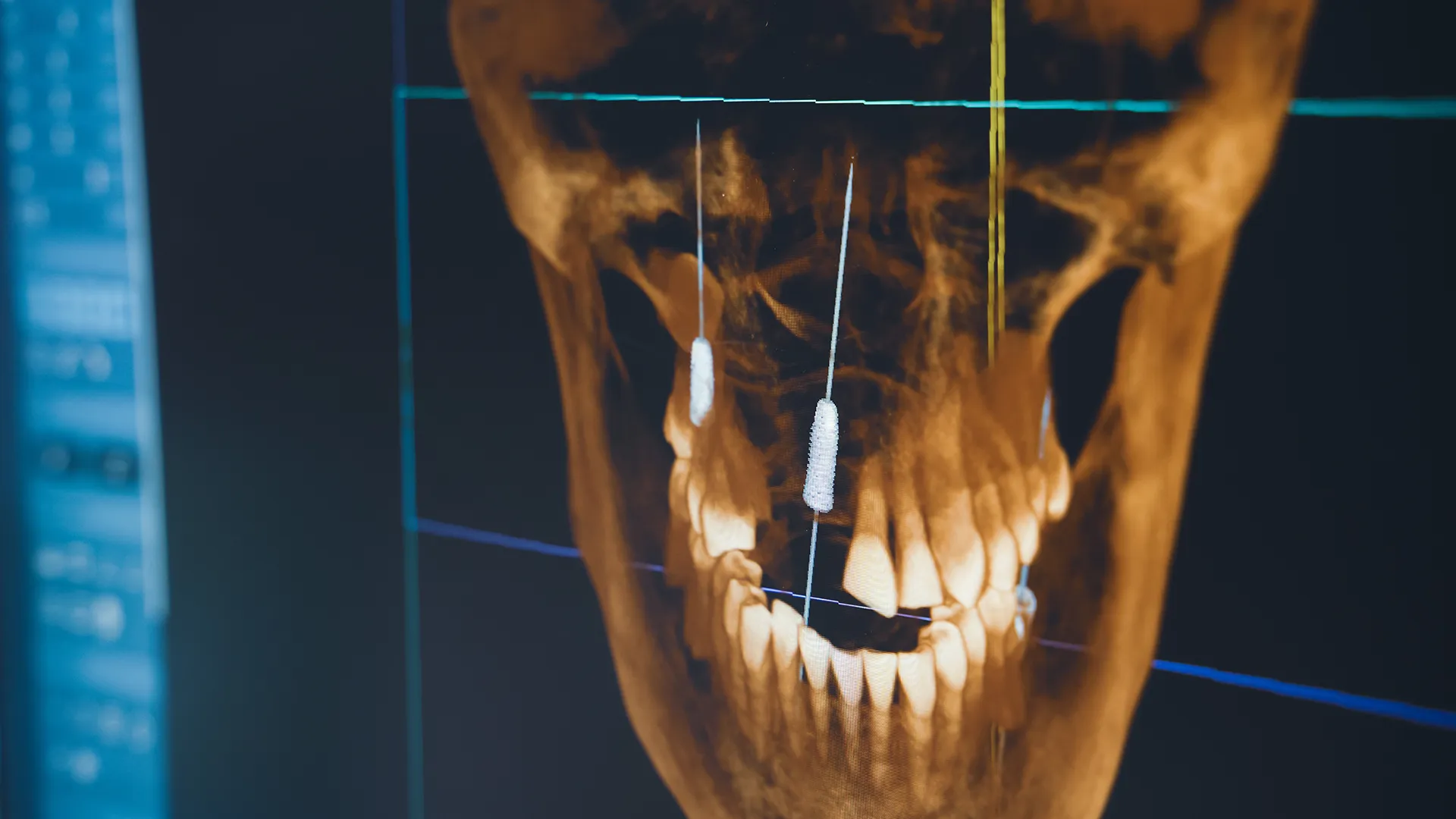 A nice denture