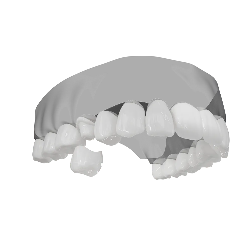 A 3D illustration of a crown being placed.