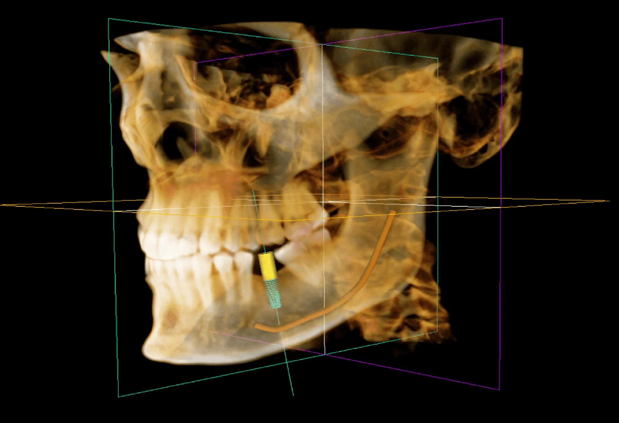 A CT scan of the whole mouth.