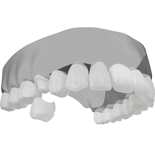 A 3D illustration of a crown being placed.